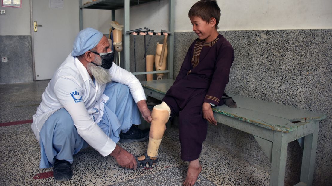 Der 9-jährige Ali aus Afghanistan bekommt von HI eine Prothese angepasst. 