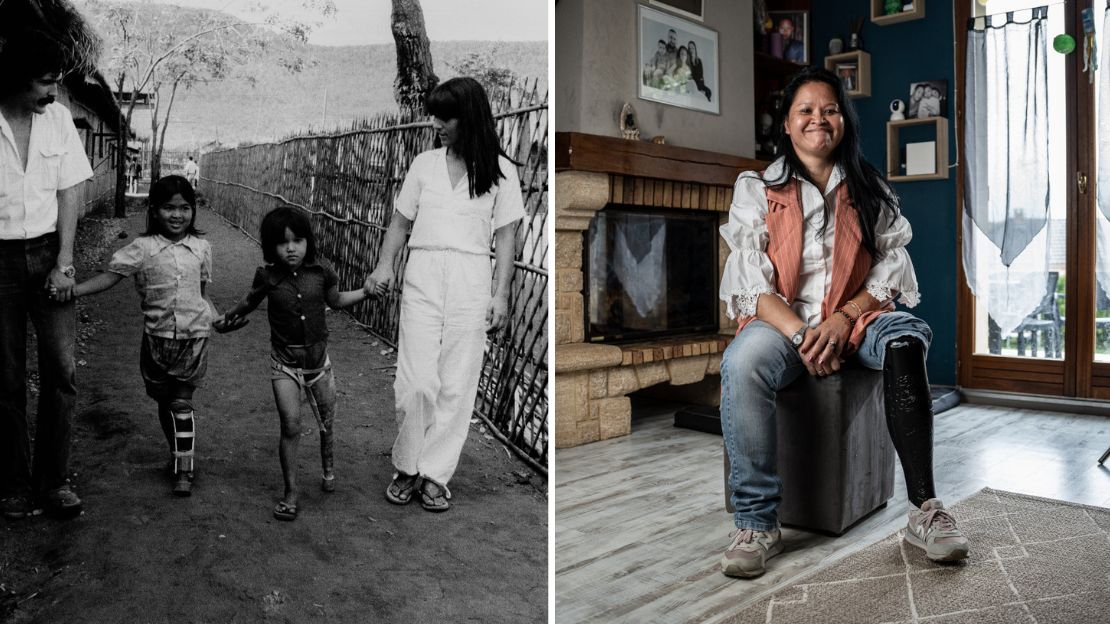 Links ist Emelie als Kind mit einer Unterbeinprothese aus Bambus zu sehen. Das Schwarz-Weiß-Bild zeigt außerdem ein anderes Kind mit einer Beinprothese und zwei Betreuende. Rechts ein aktuelles Bild von Emelie. Sie sitzt in lächelnd in der Mitte eines Raumes, ihre hochgekrempelte Hose zeigt ihre schwarze Unterbeinprothese.