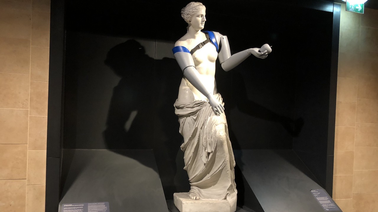 Die Venus von Milo in der Metrostation des Louvre in Paris wurde vorübergehend mit Armprothesen bestückt.