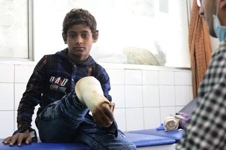 Der Junge Abdullah hat durch den Krieg in Jemen ein bein verloren.