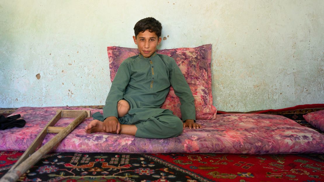 Omaid aus Afghanistan hat mit 5 Jahren ein Bein durch eine Landmine verloren. Er sitzt auf einem Bett und schaut in die Kamera.
