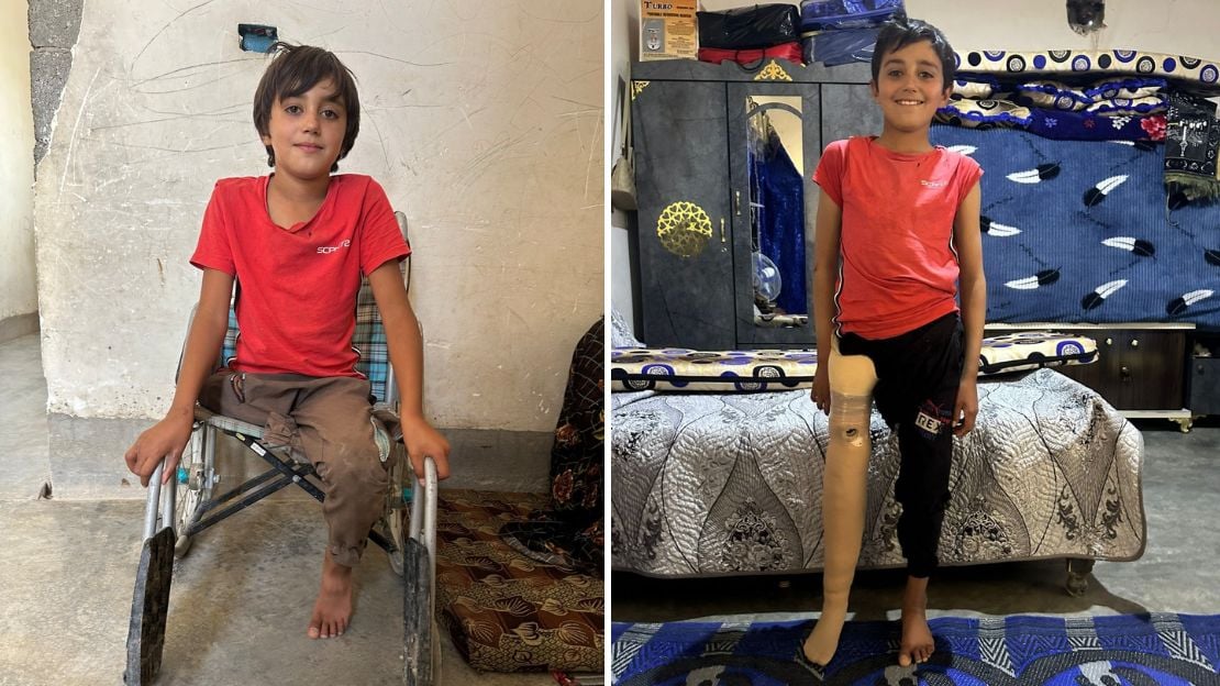 Syrien: Endlich eine Prothese für Amer