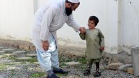 Der sechsjährige Sayed bei einer Therapie. Er lächelt leicht und hält die Hand seines Physiotherapeuten.