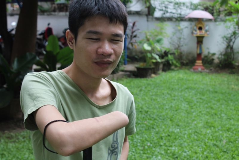 Phongsavath verlor durch eine Subminution beide Hände und das Augenlicht