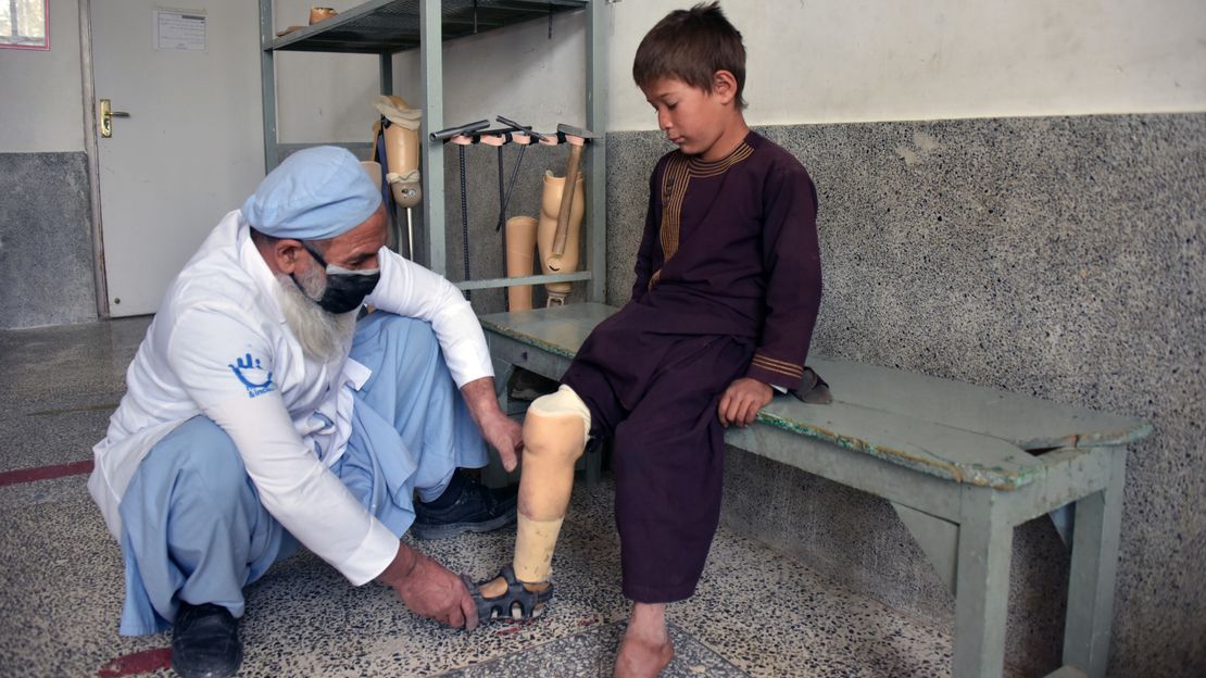 Ali hat durch einen Blindgänger sein Bein verloren. Im Reha-Zentrum in Kandahar bekommt er eine Prothese.