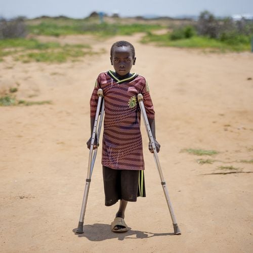 Junge aus dem Sudan mit Krücken und fehlendem Bein.