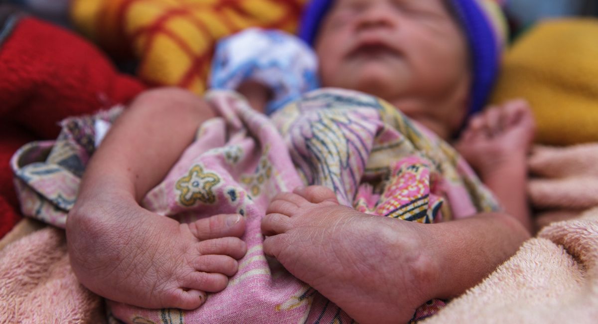 Ein neugeborenes Baby mit Klumpfüßen