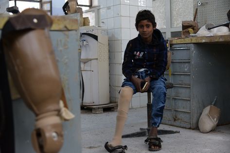 Der 12-jährige Abdullah verlor bei einem Luftangriff im Jemen sein rechtes Bein.