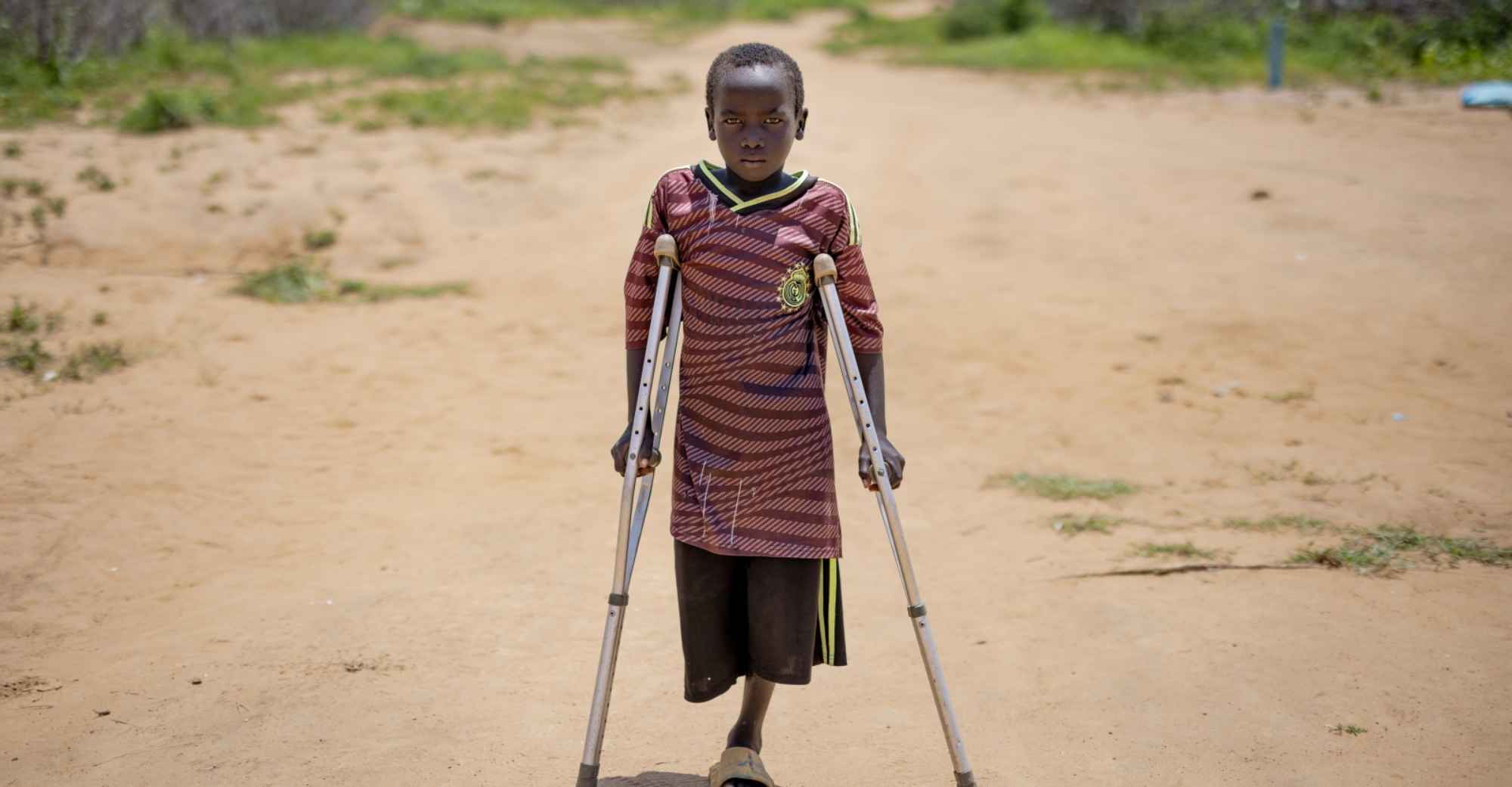 Ein Junge trägt ein Fußballtrikot und steht auf Schotterweg. Er stützt sich auf Krücken und er hat nur ein Bein.