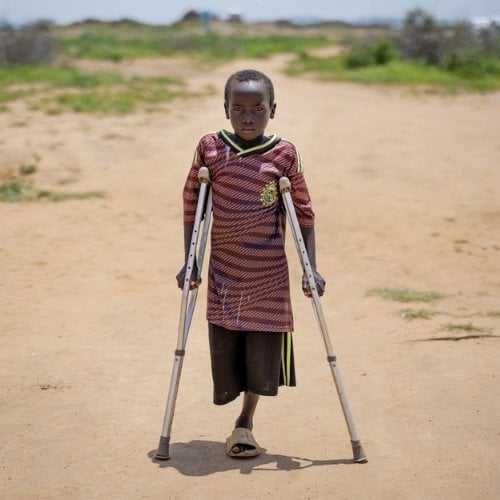 Ein Junge trägt ein Fußballtrikot und steht auf Schotterweg. Er stützt sich auf Krücken und er hat nur ein Bein.
