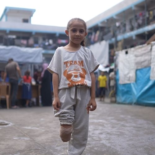 Ein Mädchen mit Beinamputation steht auf einem großem Hof. Um sie herum sind einige Menschen. 