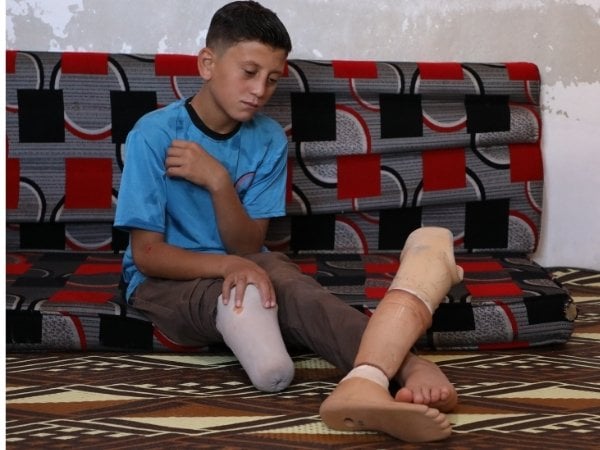 Ein junge sitzt auf einem Polster und schaut auf sein amputiertes Bein, neben ihm liegt seine Beinprothese.