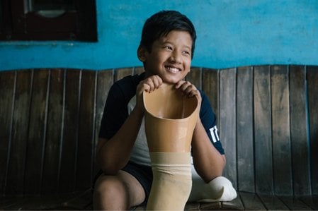 Auf einer Bank sitzt ein Junge mit einem amputierten Bein. Er stützt sein Kinn auf seine Beinprothese und schaut lächelnd zur Seite. 