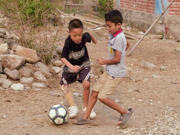 Zwei Jungen spielen Fußball. Der linke Junge trägt eine Beinprothese.