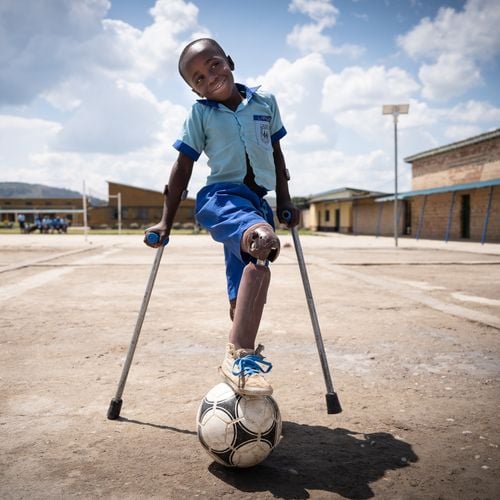 drei verschiedene Kinder mit Prothesen, die Fußball spielen