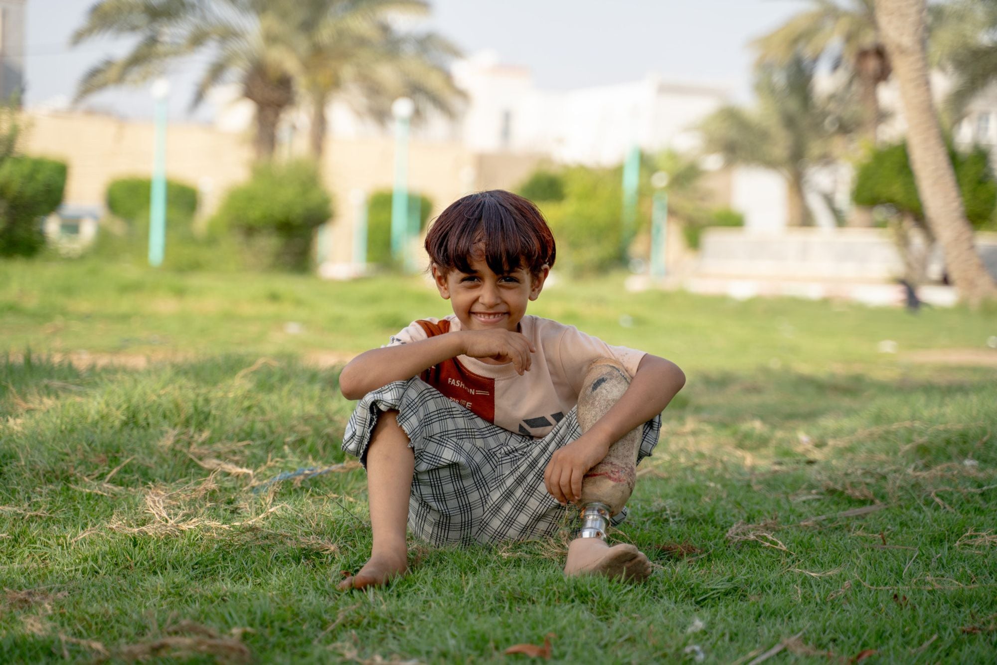 Junge aus dem Jemen mit Beinprothese sitzt auf einer Wiese und lächelt in die Kamera
