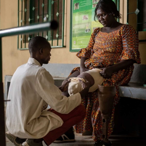 Eine afrikanische Frau sitzt auf einer Bank, ihr links Bein ist ab dem Knie amputiert. Neben ihr steht ihre Beinprothese. Vor ihr kniet ein HI-Mitarbeiter, der ihr Bein untersucht.