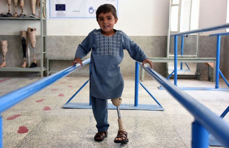 Ein kleiner Junge mit einem prosthetischen Bein, er steht an einem Haltegeländer und lächelt