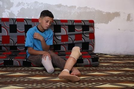 Ein Mädchen mit Beinprothese kniet und wäscht Geschirr ab.