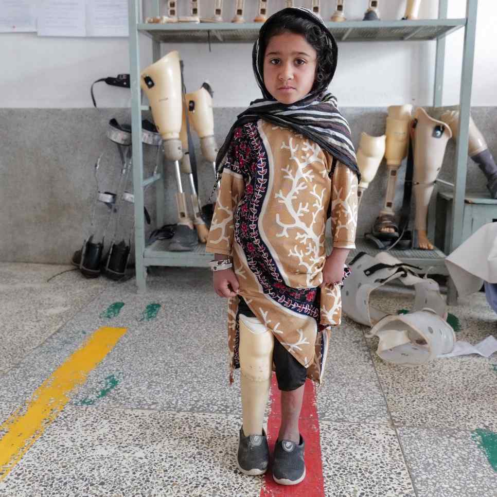 Die 7-jährige Amina aus Afghanistan mit Beinprothese am rechten Bein bei der Reha.